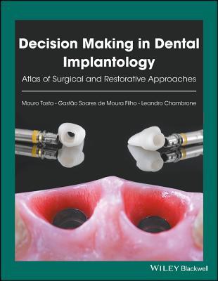 Read Decision Making in Dental Implantology: Atlas of Surgical and Restorative Approaches - Mauro Tosta | PDF