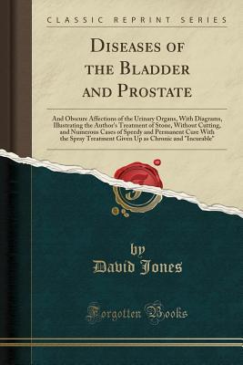 Read Online Diseases of the Bladder and Prostate: And Obscure Affections of the Urinary Organs, with Diagrams, Illustrating the Author's Treatment of Stone, Without Cutting, and Numerous Cases of Speedy and Permanent Cure with the Spray Treatment Given Up as Chronic - David Jones file in ePub