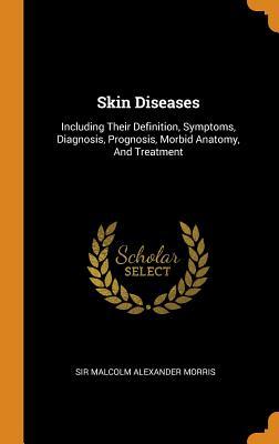 Download Skin Diseases: Including Their Definition, Symptoms, Diagnosis, Prognosis, Morbid Anatomy, and Treatment - Sir Malcolm Alexander Morris file in ePub